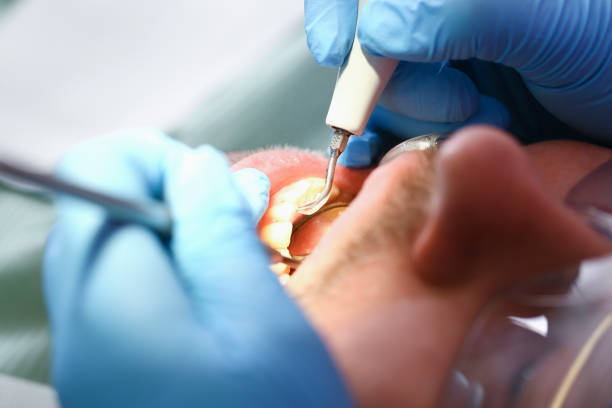 Best Walk-In Emergency Dentist in Eureka, CA