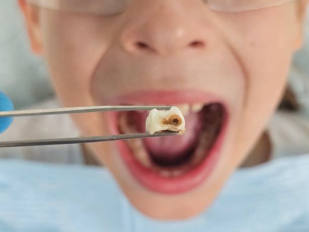 Best Pediatric Emergency Dentist in Eureka, CA